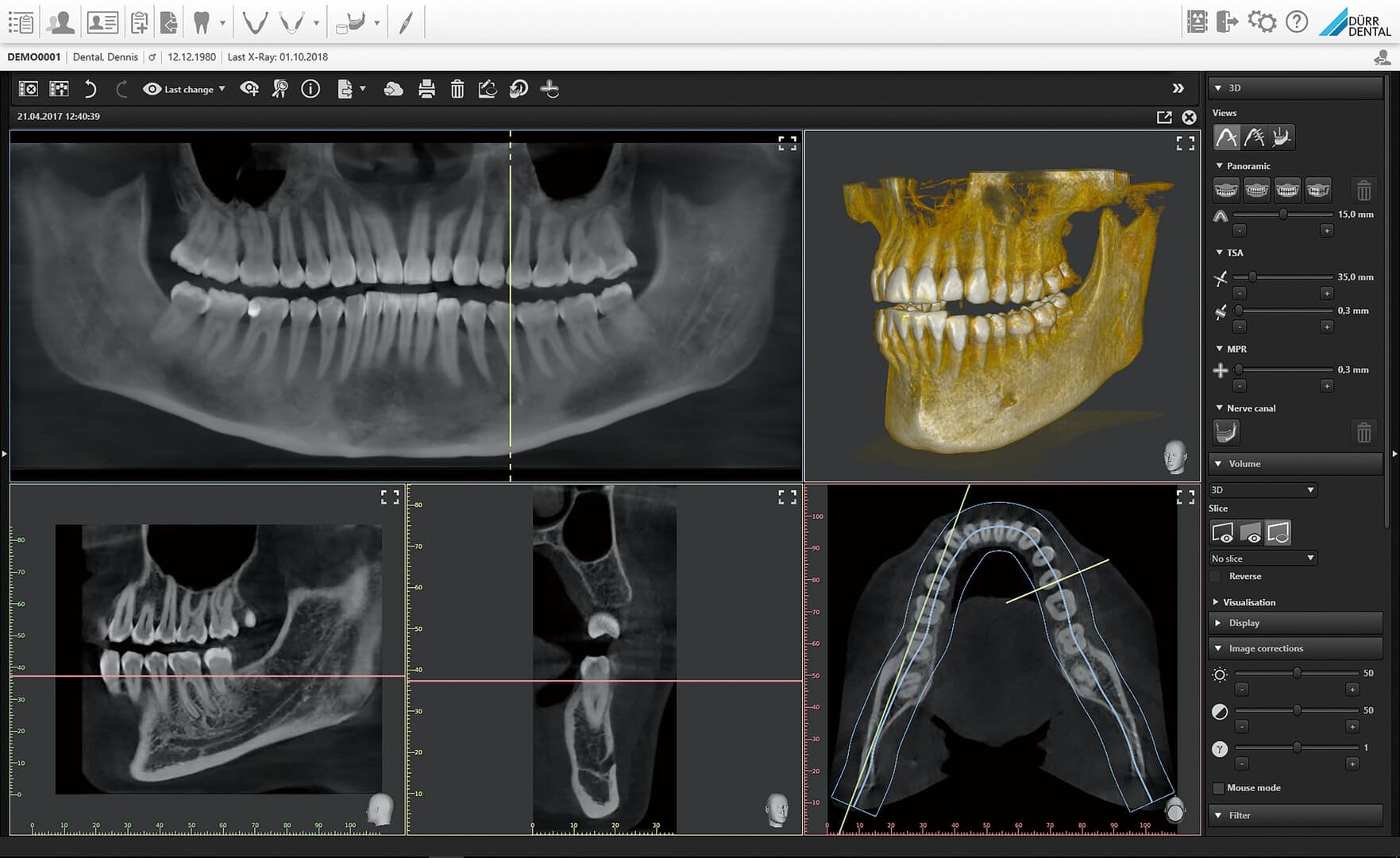 Dürr Dental VistaVox S 3D