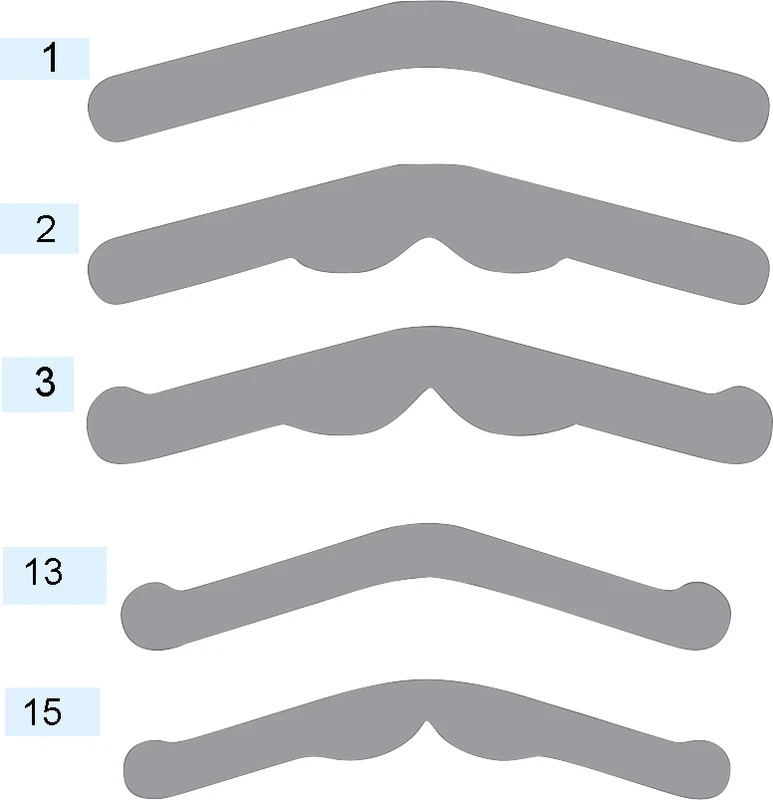 Matrizen nach Tofflemire Kerr