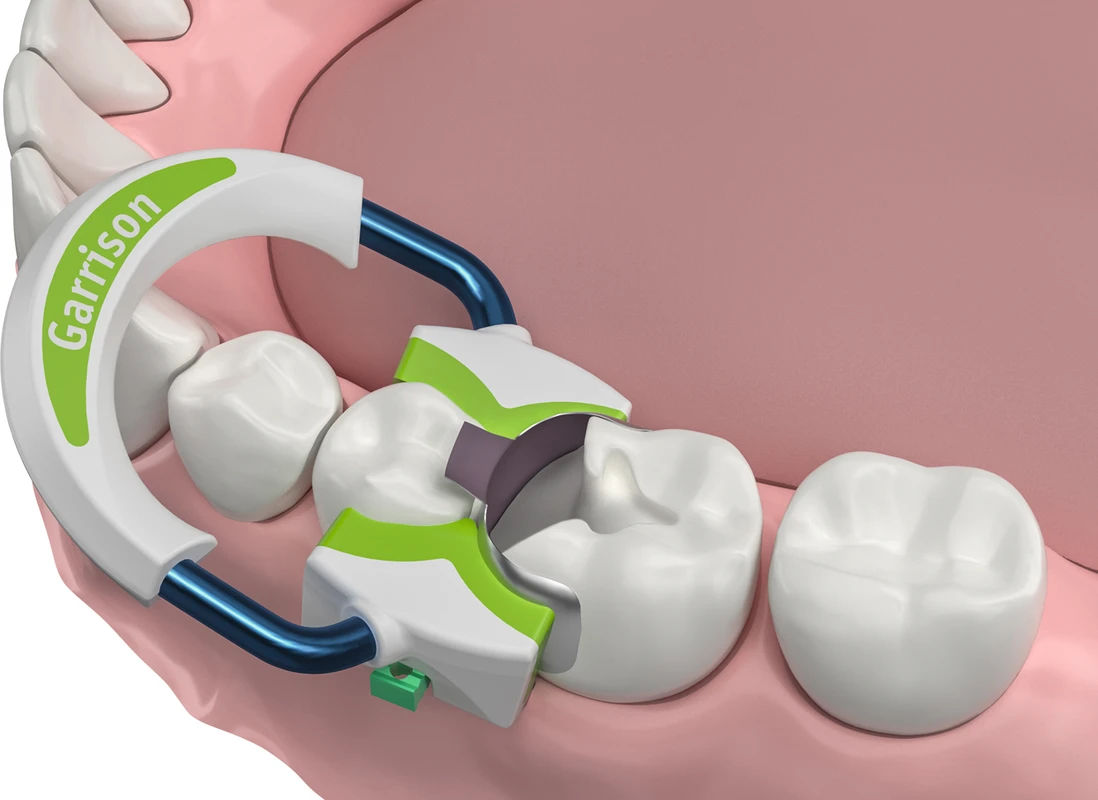 Strata-G™ Teilmatrizen-Ringe Stück Stück breit, grün