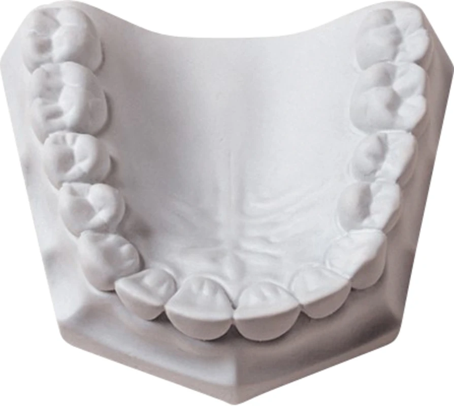 Mounting Stone Karton 15 kg Spezialhartgips weiß