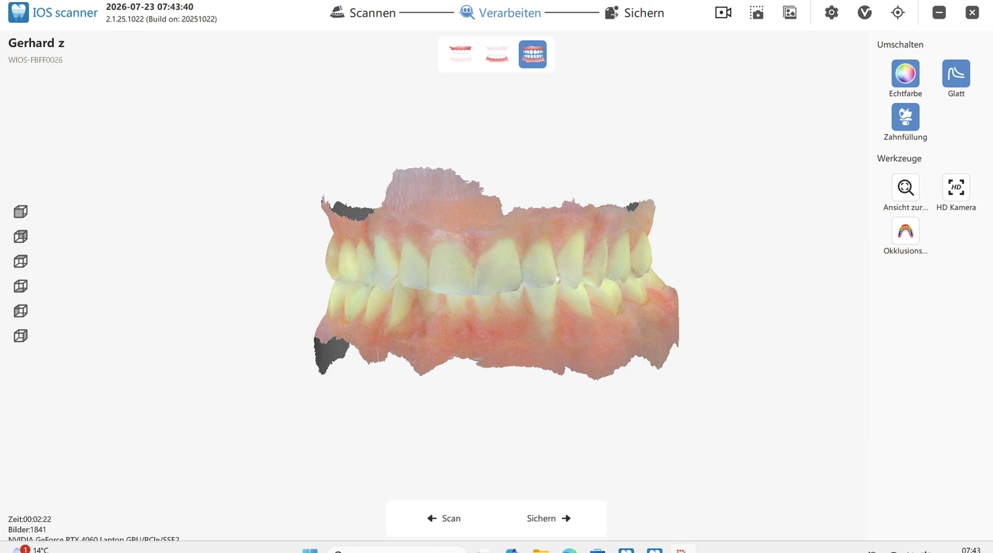 DX Mobile Koffer Intraoralscanner inklusive Zubehör