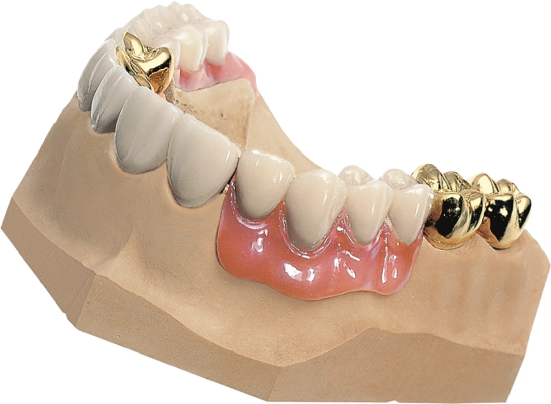 MOLDASTONE® Beutel 4,5 kg hellbraun