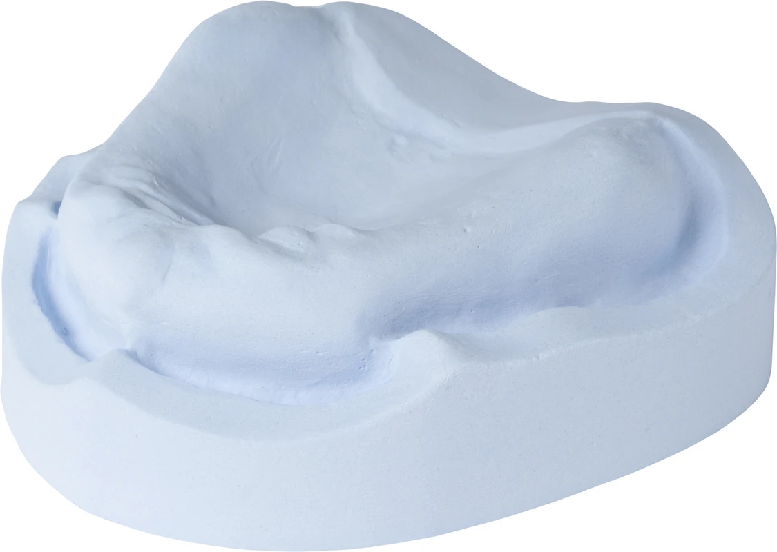 dento-dur® 110 Karton 25 kg blau