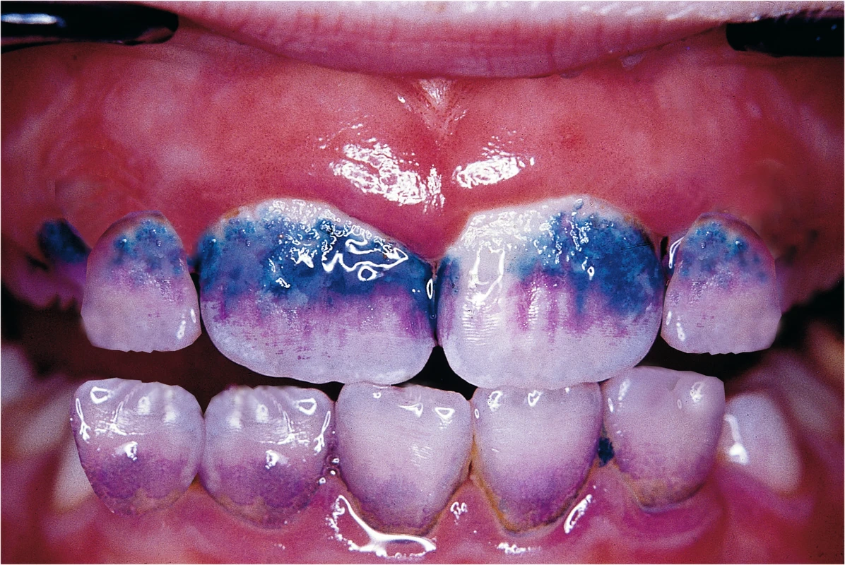 MIRA-2-TON® Hager &amp; Werken