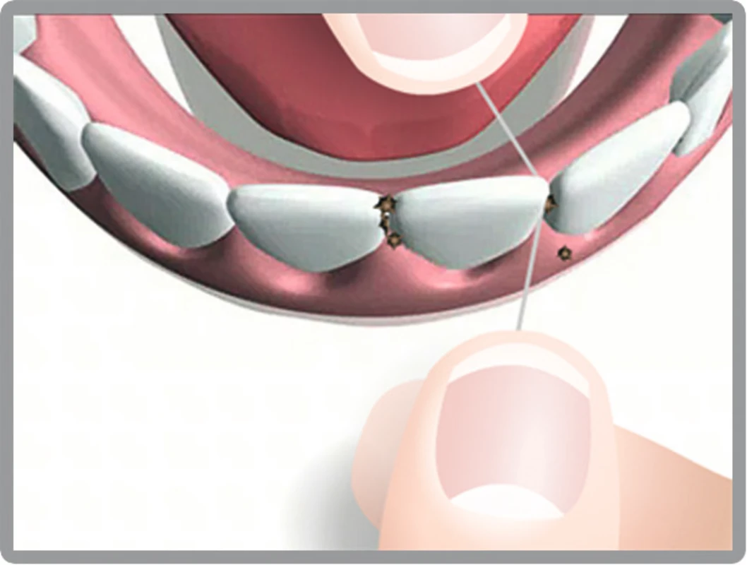 Mirafloss® Hager &amp; Werken