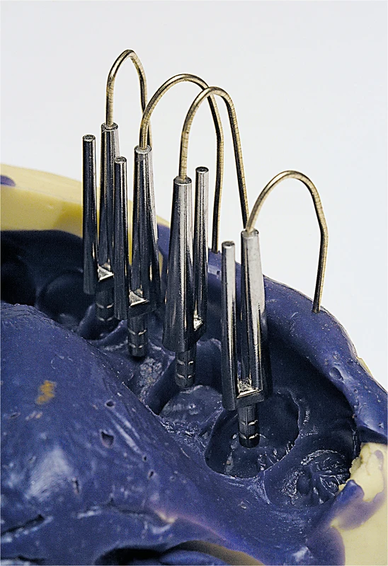 Bi-Fix-Pin Packung 100 Stück hart