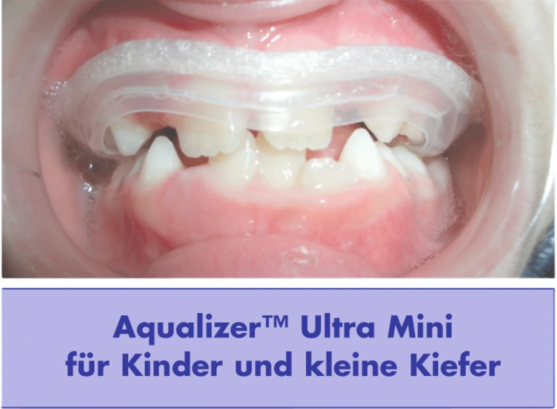 Aqualizer™ Stück ultra high