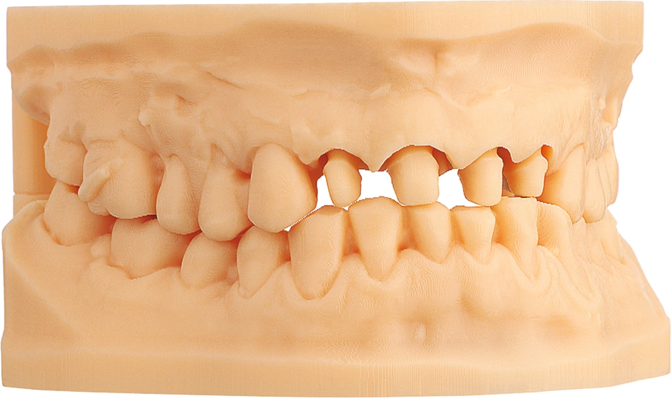 IMPRIMO® LC/LCD SCHEU-DENTAL