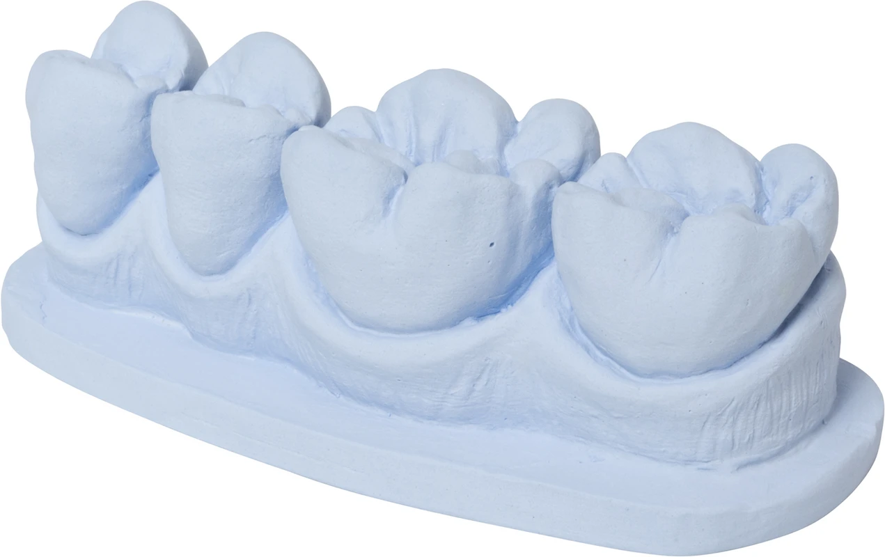 dento-dur® 110 Karton 25 kg blau