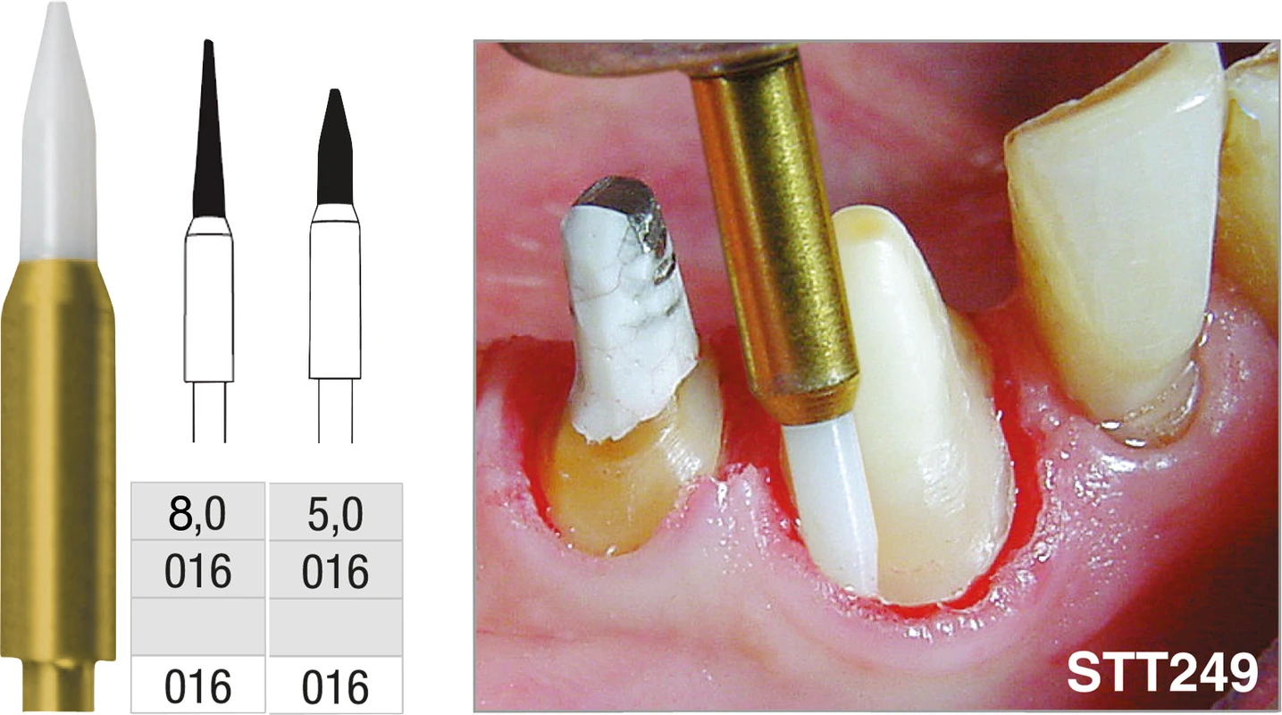 Soft Tissue Trimmer Stück 5 mm, ISO016, FG249