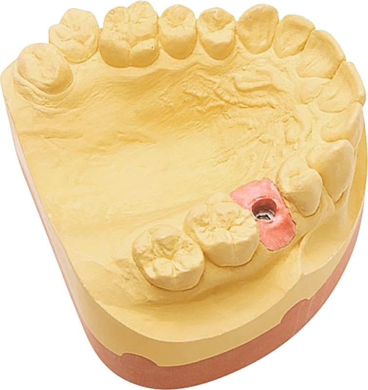 Majesthetik-Gingiva scan Set 2 x 50 ml Doppelkartuschen, 12 Mischkanülen