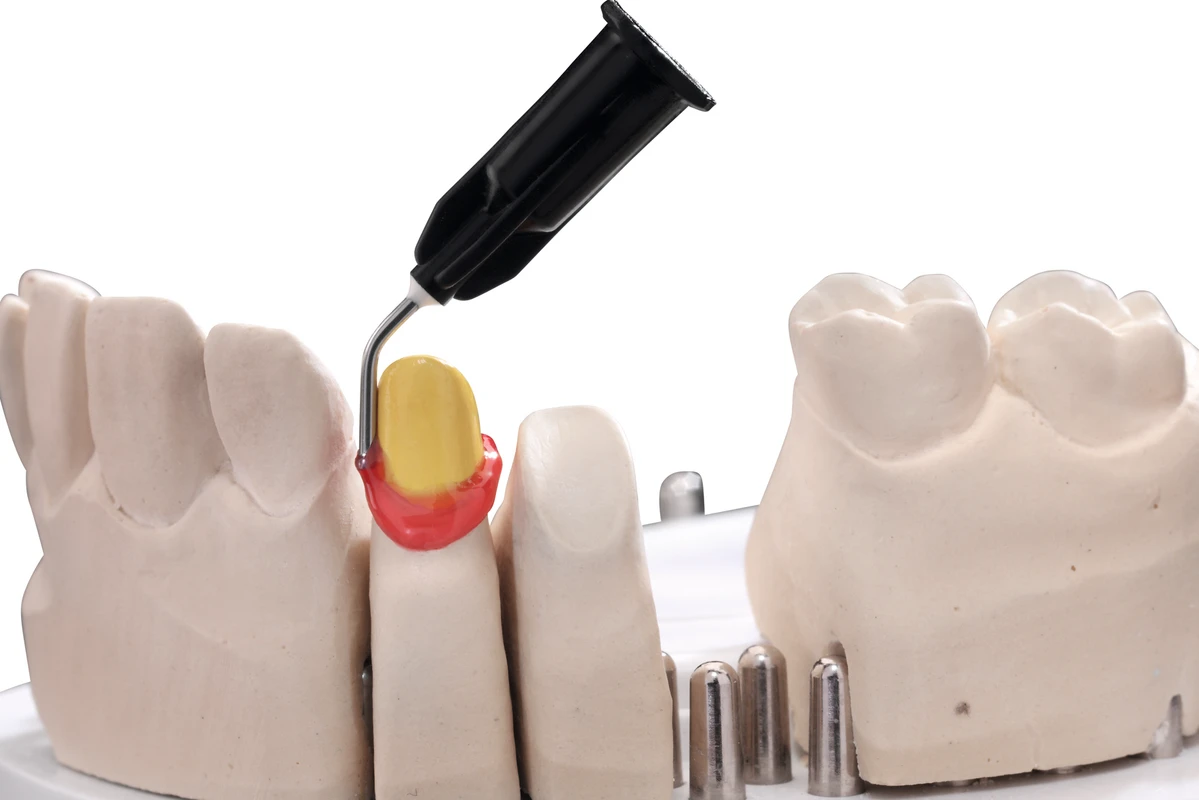 Gracey Küretten Standard Hu-Friedy