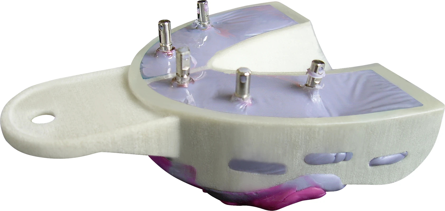 Miratray® Implant Hager &amp; Werken