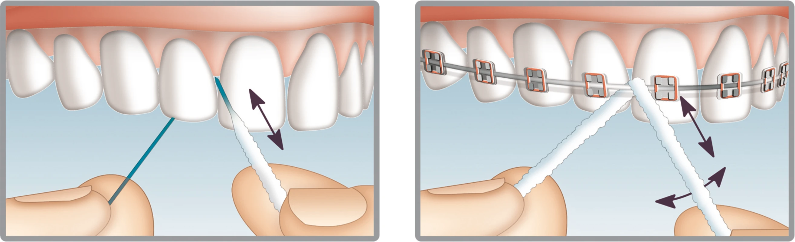 Mirafloss® Implant Rolle 20 Stück medium, Ø 2,2 mm, 15 cm Mirafloss® Implant Hager & Werken