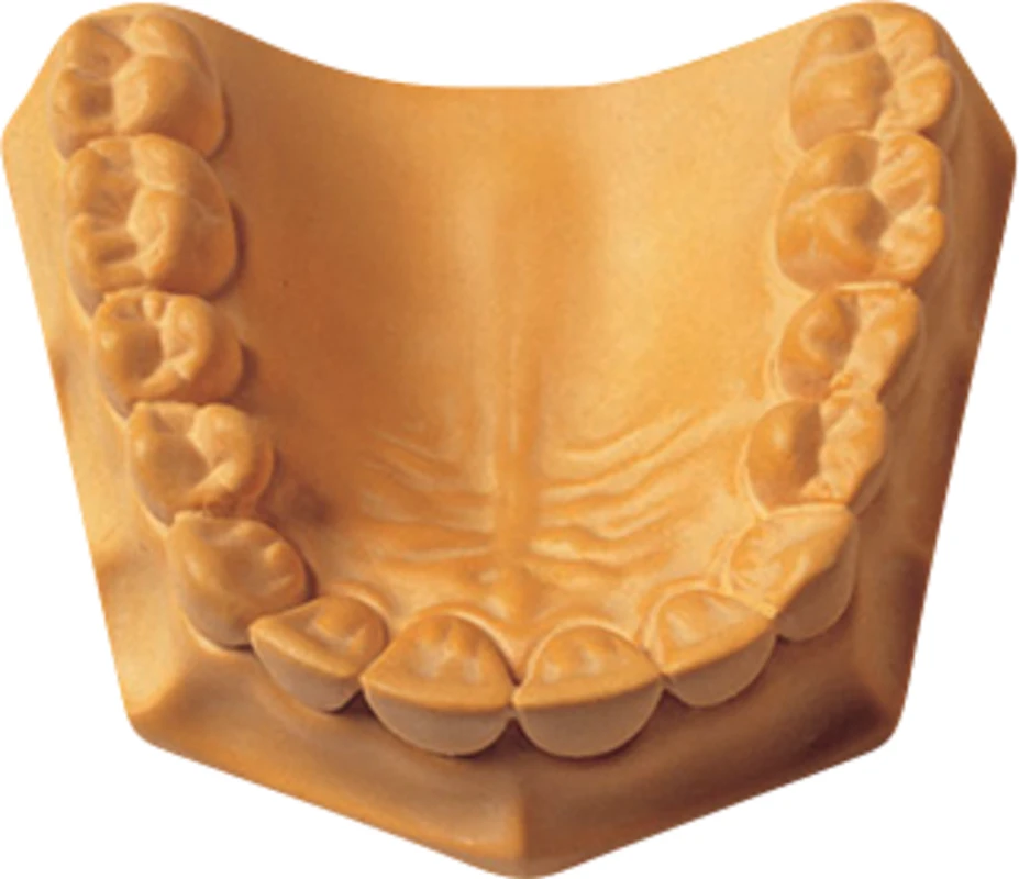 Prima-Rock Karton 15 kg yellow