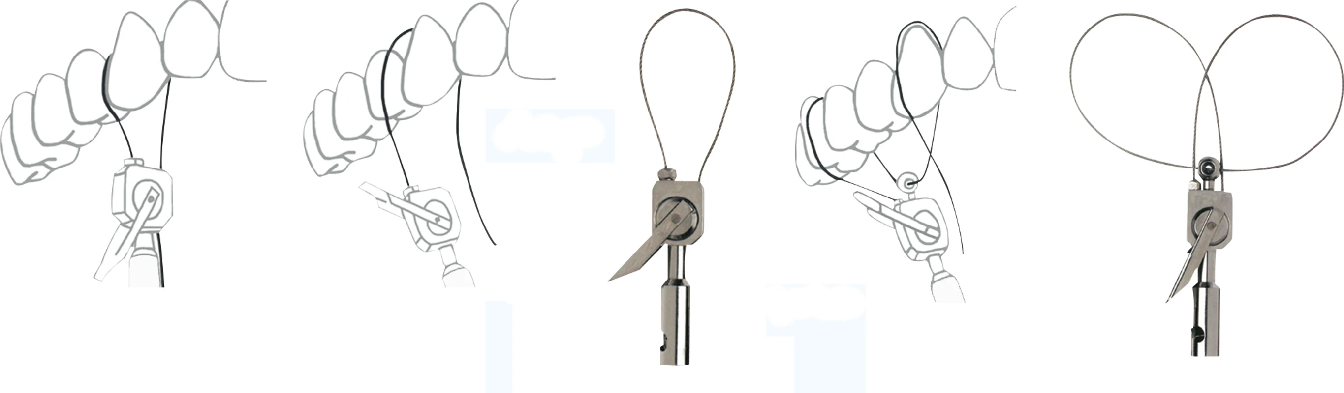 KKD® Loop-Tips Packung 2 Stück 190 mm, 1 Double-Loop