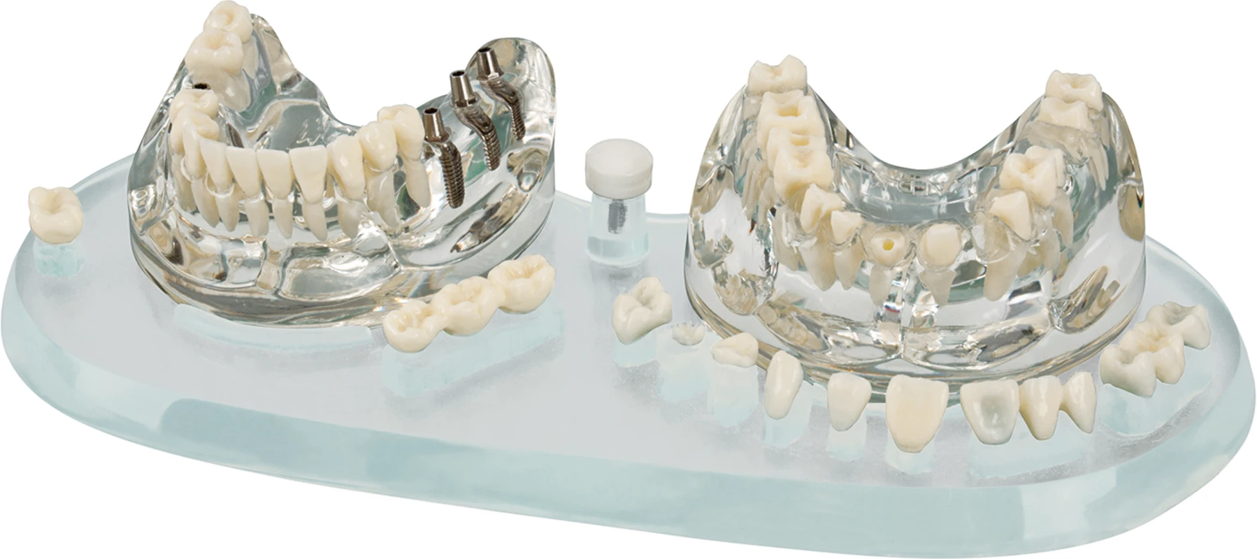 Studienmodell Demo Implant C&B Stück Studienmodell Demo Implant C&B Hager & Werken